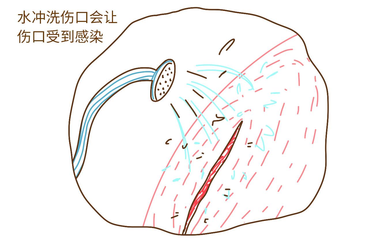 产后真的不可以洗澡吗? 听听过来人给你的建议