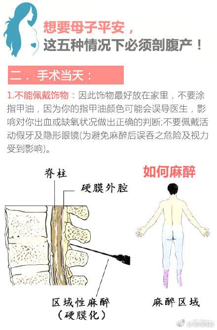 想要母子平安, 这五种情况下最好还是剖腹产!