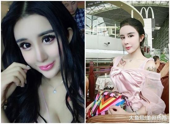 14岁就开始整容成“蛇精脸”, 因炫富走红, 现在又把脸整成了混血