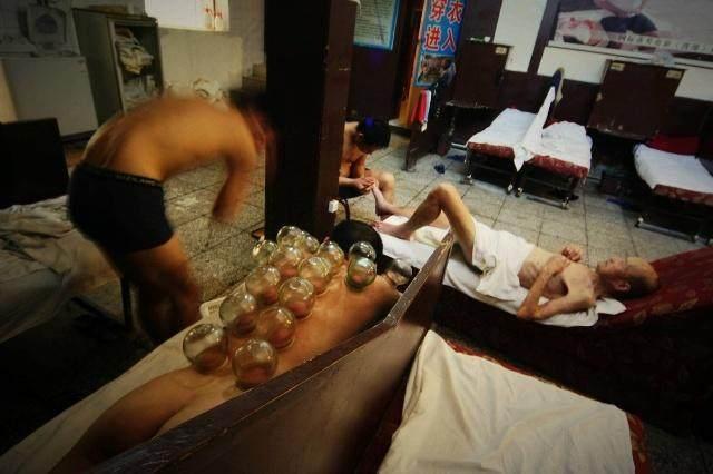 男子洗澡后拔火罐, 差点死在澡堂! 拔火罐要注意6点