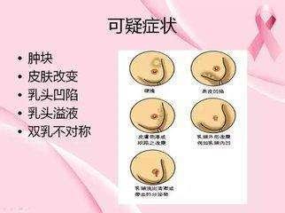 28岁女子乳腺癌, 不吸烟、不喝酒! 医生说: 只怪一件事