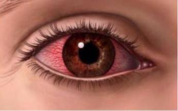 眼睛出现几种情况, 说明身体出现了问题, 长期下去很严重!