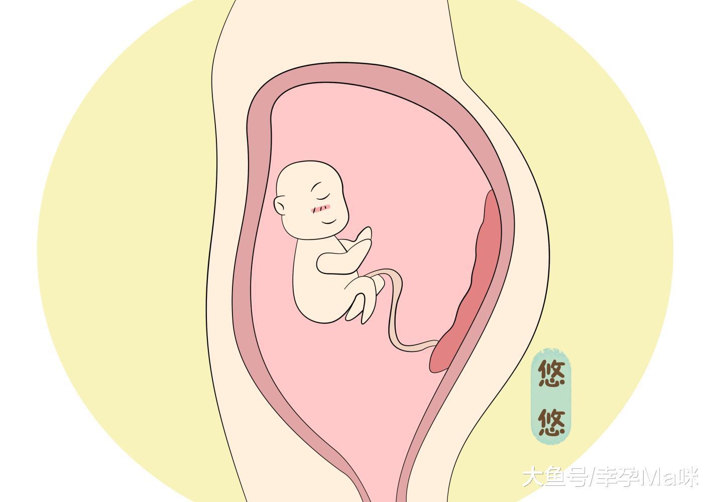 胎盘前壁后壁不一样, 别乱猜测, 早做到正确了解