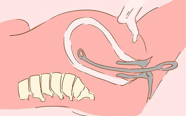 这部分人流产后应该尽早再次怀孕, 越拖流产率越高