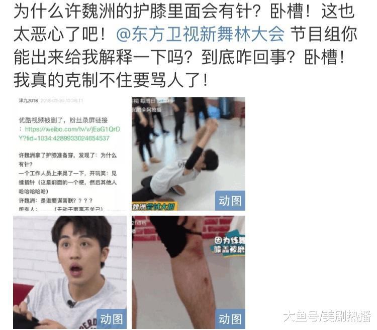 《新舞林大会》许魏洲护膝中居然有针, 网友: 节目组必须给说法!