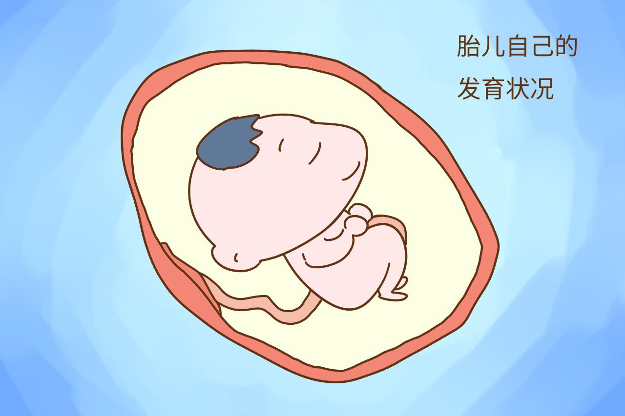 还在剖腹产和顺产中犹豫不决的准妈妈们, 选哪个答案在这里