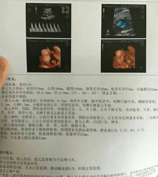 生了6斤9两男宝宝一枚, 付B超及孕期症状