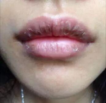 口干、口苦, 或许是肝出了3种问题, 养肝护肝坚持用“它”泡水喝