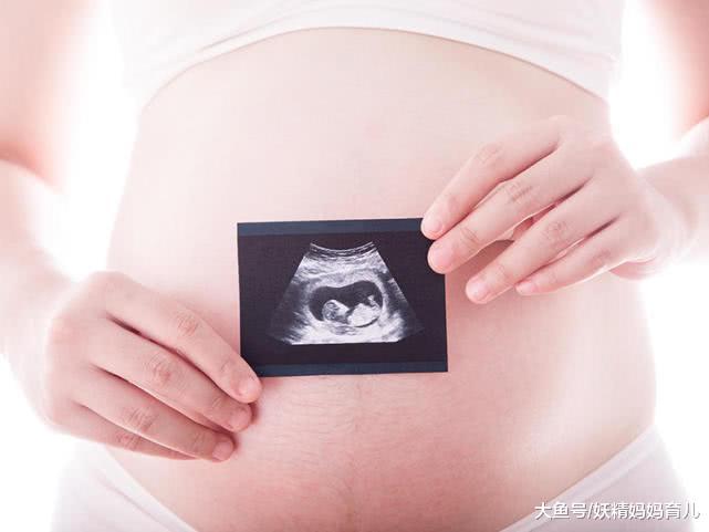 孕妇失眠怎么办? 孕妇做好这9点, 晚上才能睡得香