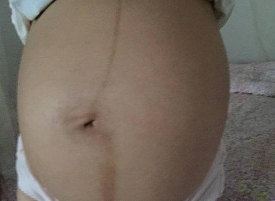 90后妈妈产下7斤男宝, 孕期症状及肚型分享