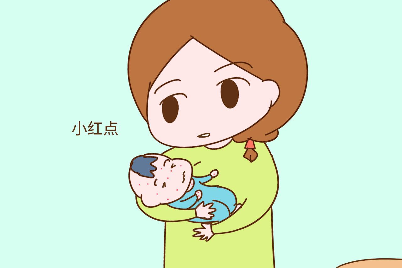 湿疹、小儿急疹、痱子长得太像分不清? 这几个区别能帮到你