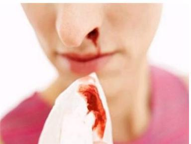 鼻子出血不重视, 你还觉得是小事吗? 这些情况你需要了解!