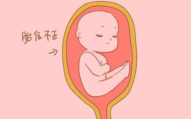 唐筛? 糖筛? 傻傻分不清楚, 里面的区别大着呢, 孕妈要清楚