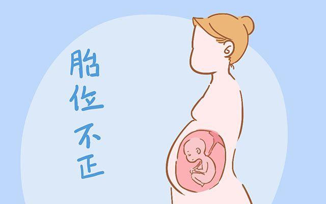 如果第一胎是剖腹产, 那么后面还能顺产? 看看医生怎么说