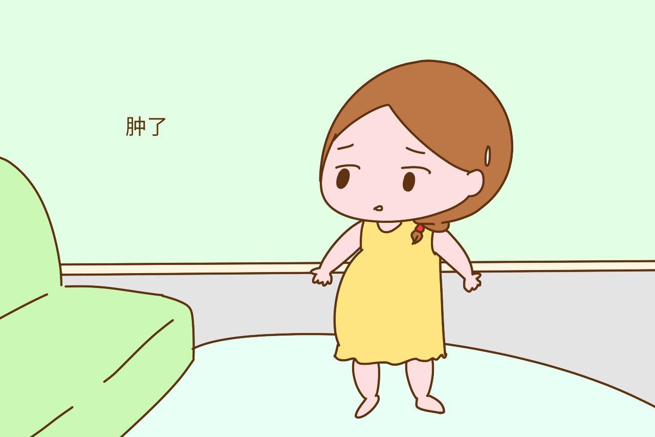 孕期双脚水肿像蹄膀怎么办? 3个简单的方法帮你减轻水肿
