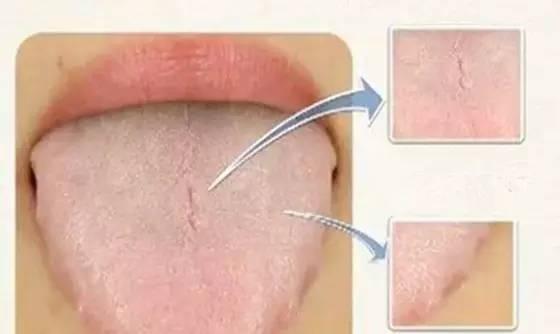 湿气重到底有什么危害? 切记不要吃这些食物, 越吃湿气就越重!