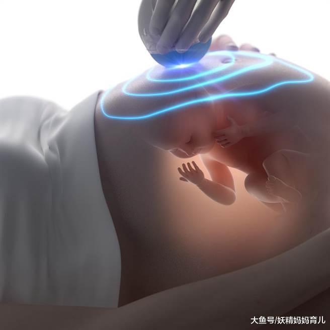 怀孕后高层次超音波做不做? 先了解这5个问题, 再决定