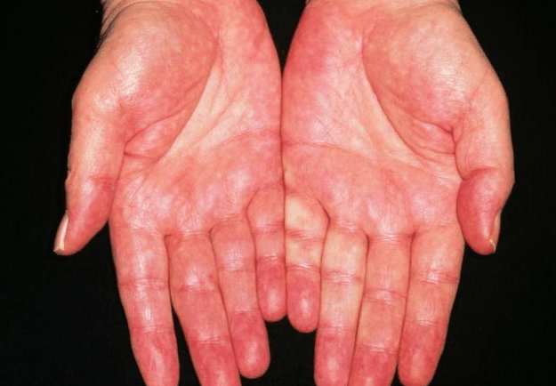 想知道你自己的肝好不好? “竖起中指”看看吧, 身体是不会撒谎的