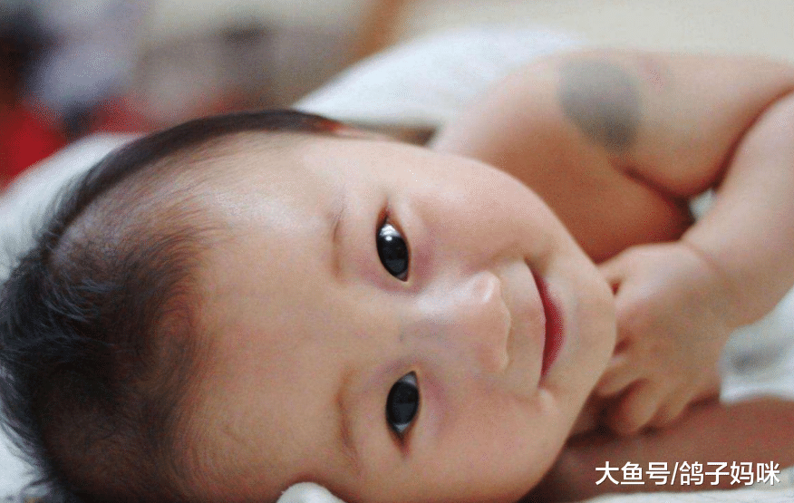 怎么预防儿童有胎记? 儿科专家这样说
