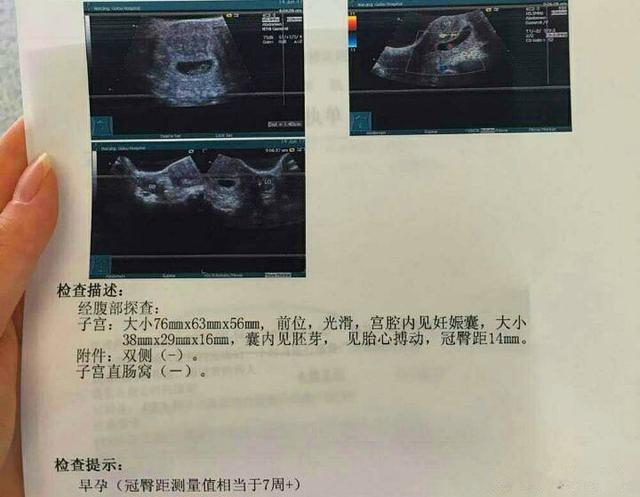 超快顺产8.5斤女宝宝, 详细记录孕期症状