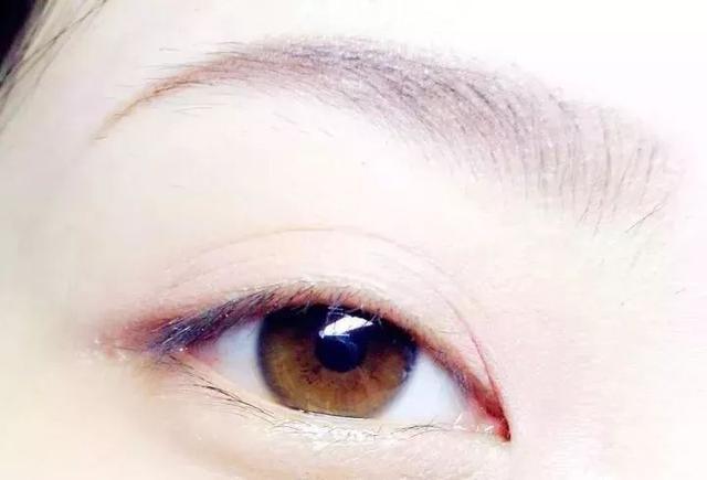 眼睛出现几种情况, 说明身体出现了问题, 长期下去很严重!