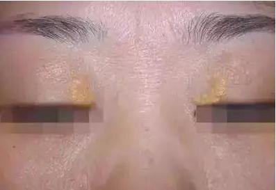 眼睛出现几种情况, 说明身体出现了问题, 长期下去很严重!
