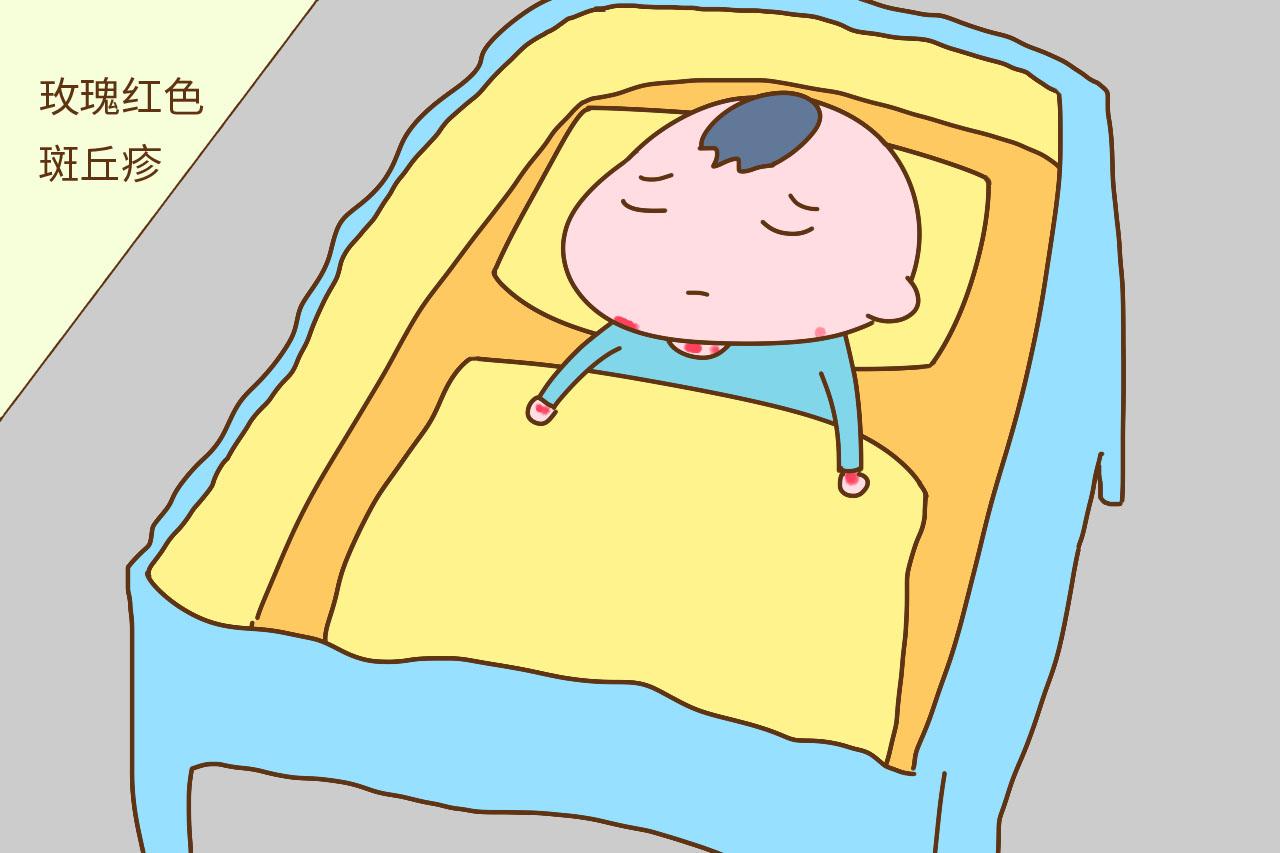 儿科医生: 大多数宝宝都逃不掉的幼儿急疹, 这样应对才正确