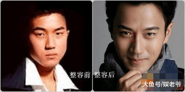 男明星整容也疯狂, 这些男明星居然都整过容?