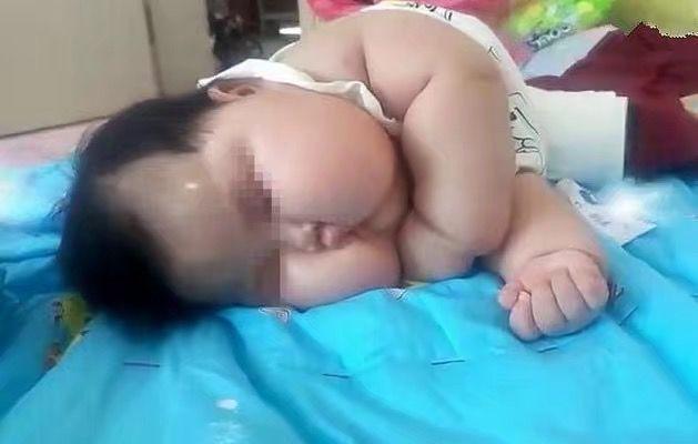 孩子一出生后, 家人就给他各种补, 现在长成这样
