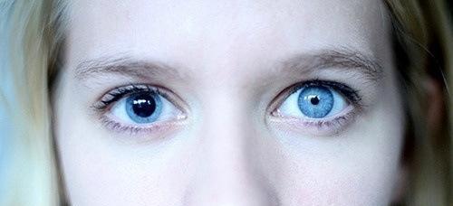 眼睛出现几种情况, 说明身体出现了问题, 长期下去很严重!