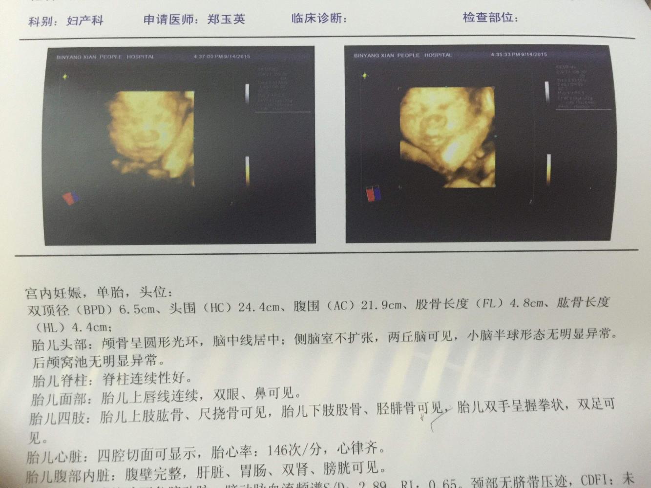 顺利产下健康男宝一枚, 来说说孕期坎坷经历!