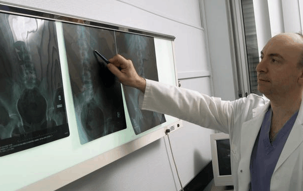 中老年防治动脉硬化, 切记“一查, 二做, 三注意”! 养血管超简单