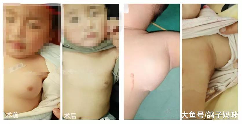 抱孩子的举动, 可能会伤害到“这些”宝宝!