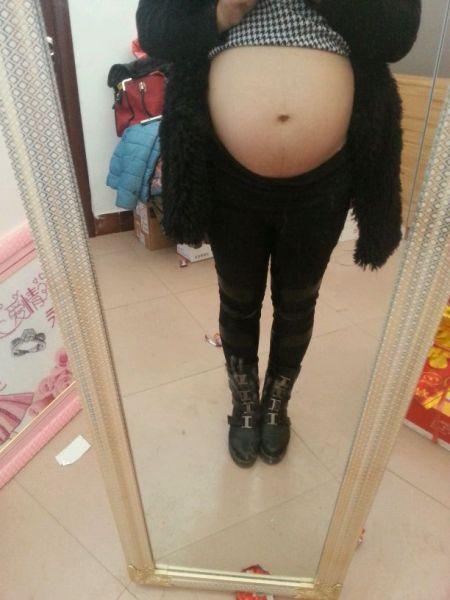 通过妊娠线可以判断生男生女吗? 有什么依据?