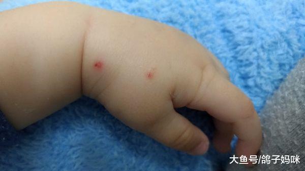 宝宝尿液中的“健康密码”, 这些妈妈平时要留意!