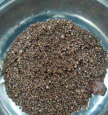 56岁阿姨肾里查出2980颗结石, 医生: 长这么大第一回见到!