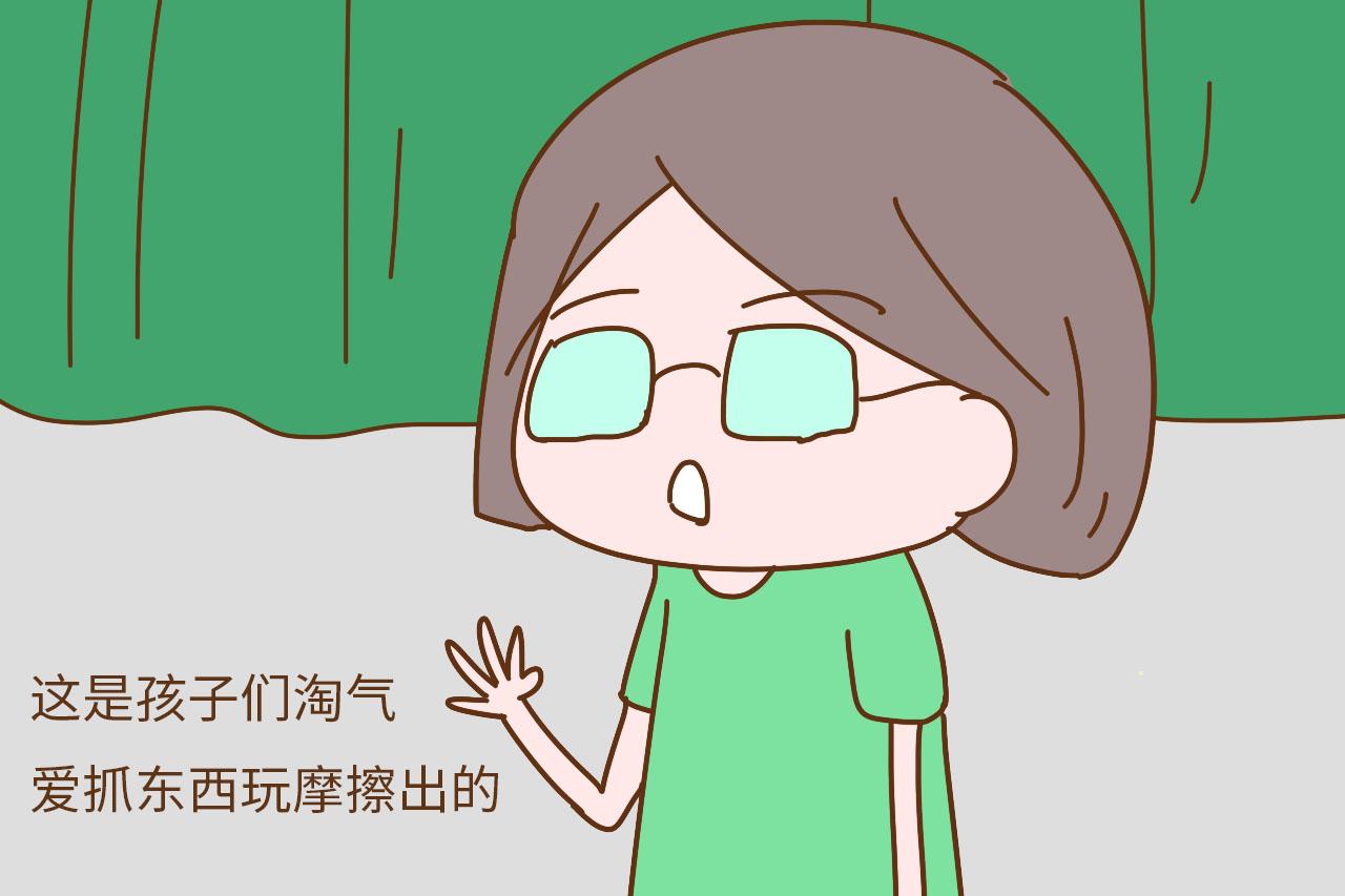 孩子一手的倒刺, 你还觉得是缺维生素? 可别造谣言了