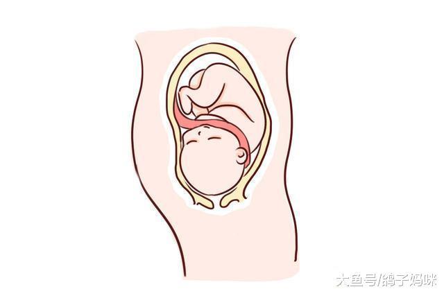 胎死腹中的预防, 要注意这几点, 多半有迹可循
