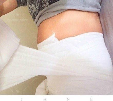 产后恢复须知：产后纱布收腹带的绑法