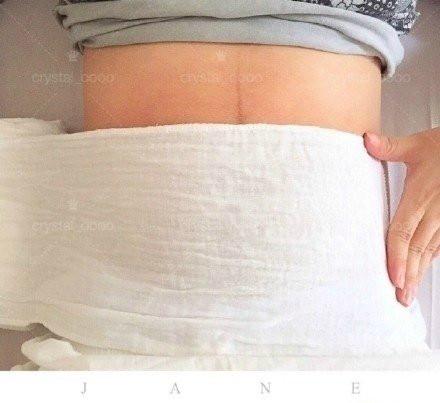 产后恢复须知：产后纱布收腹带的绑法