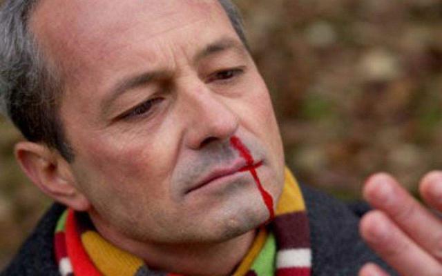 脑血栓来临前, 身体会有4个症状, 希望你不要错过!