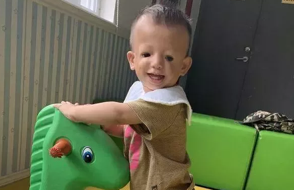 还记得轰动一时的 鸟脸夫妻 吗 不顾医生劝阻强行生二胎 如今成这样 美食资讯 存满娱乐网