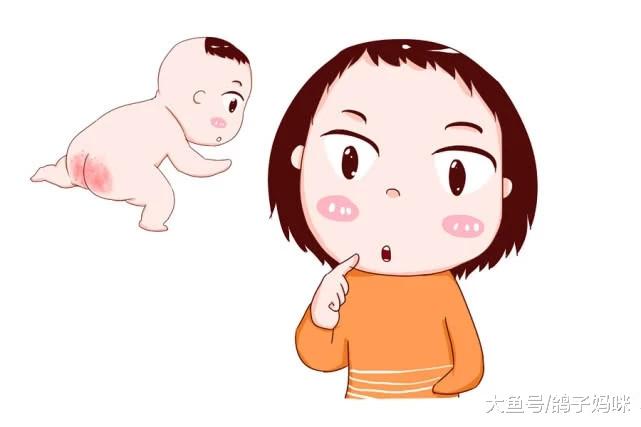 别让宝宝痒不停，预防异位性皮肤炎从小做起