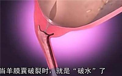 顺产全过程(附图), 母亲太伟大了