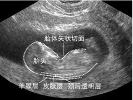 准妈妈看过来！孕期不能错过的4项检查