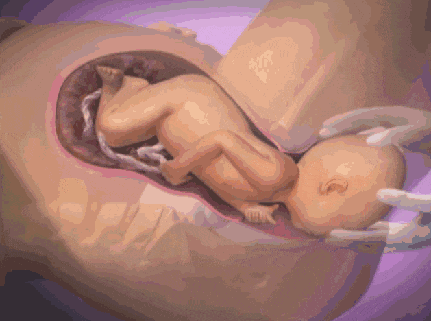 图解顺产、剖腹产全过程！女人生孩子太不容易了