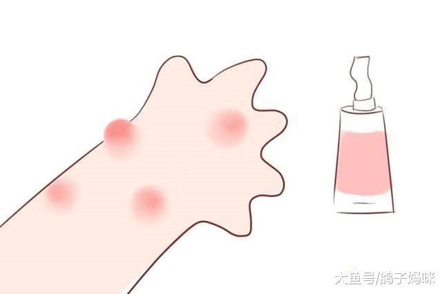 宝宝过敏有时间顺序，不要怕，这样做可以杜绝