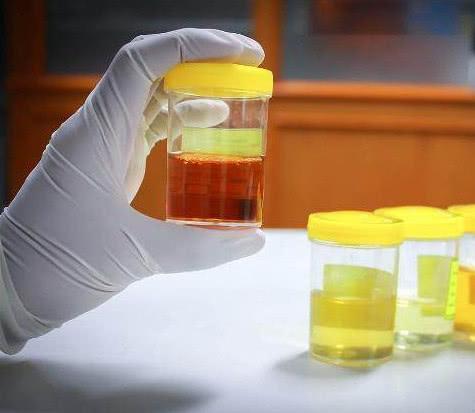 肝不好的人, 上厕所会有3种表现, 若没有, 恭喜你肝很健康!