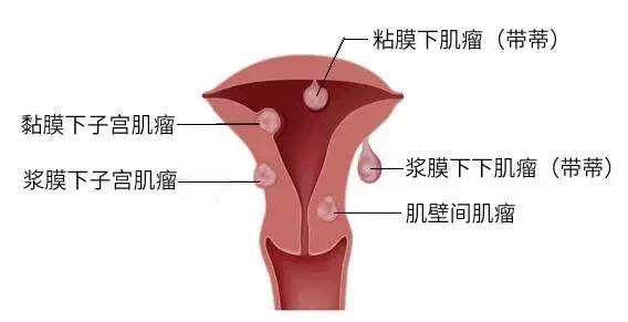 娱乐新闻