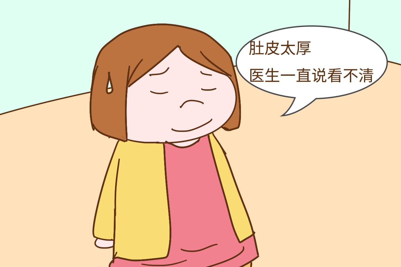 孕期四维你做了几次才过?过来人感慨:让孩子“露脸”太难了